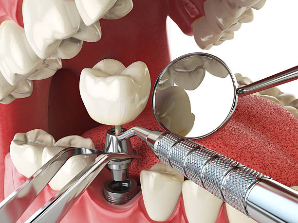 Dentist for Dental Trauma in UT